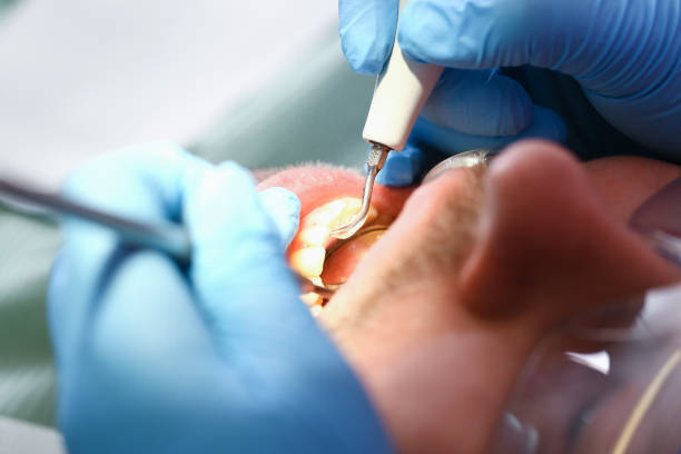 Best Tooth Infection Emergency Dentist  in Menahga, MN